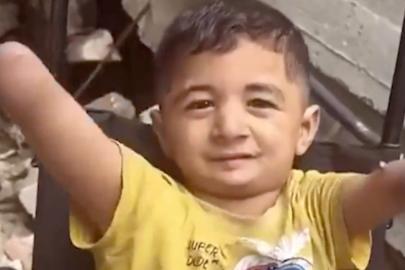 İsrail zulmünün utanç karesi: Gazzeli küçük Amir, uzuvlarını kaybetti