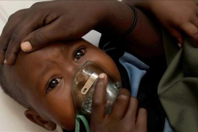 Nijerya'da Lassa ateşi nedeniyle can kaybı 70'e yükseldi